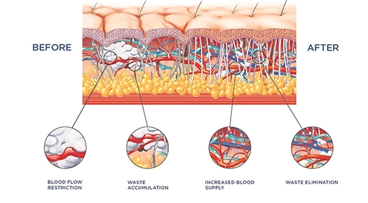 What can INTELECT Puls do?