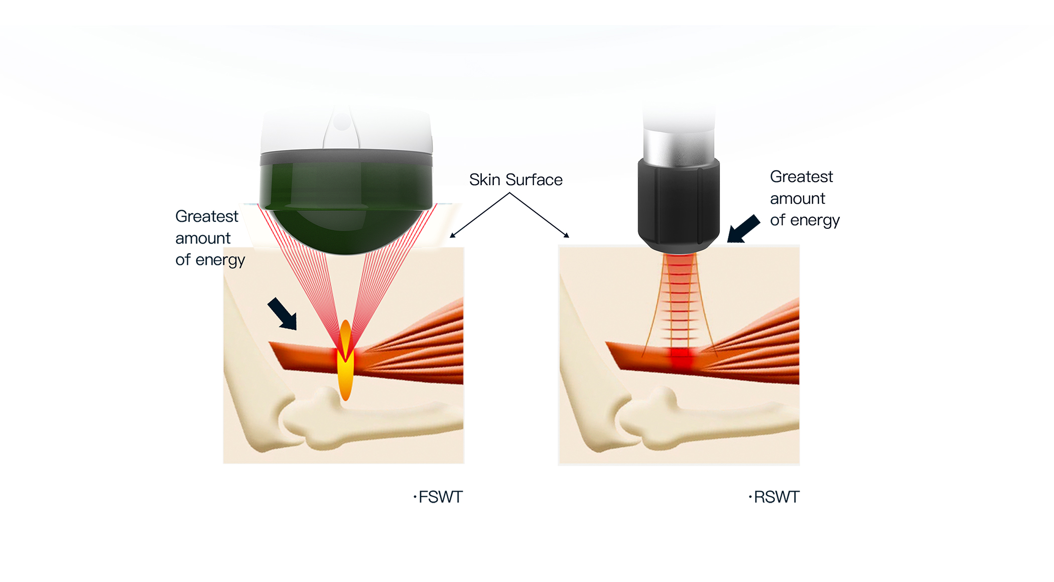 What can emfocus do?