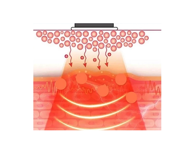 Ultrasound function