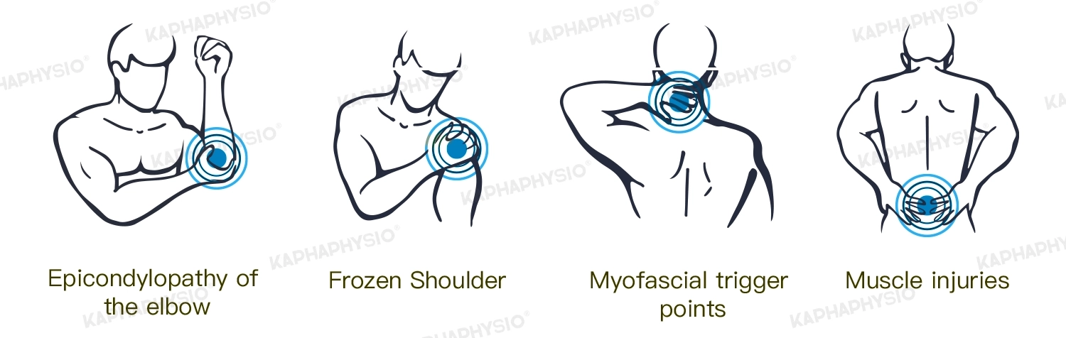 bursitis-shock-wave-therapy.webp