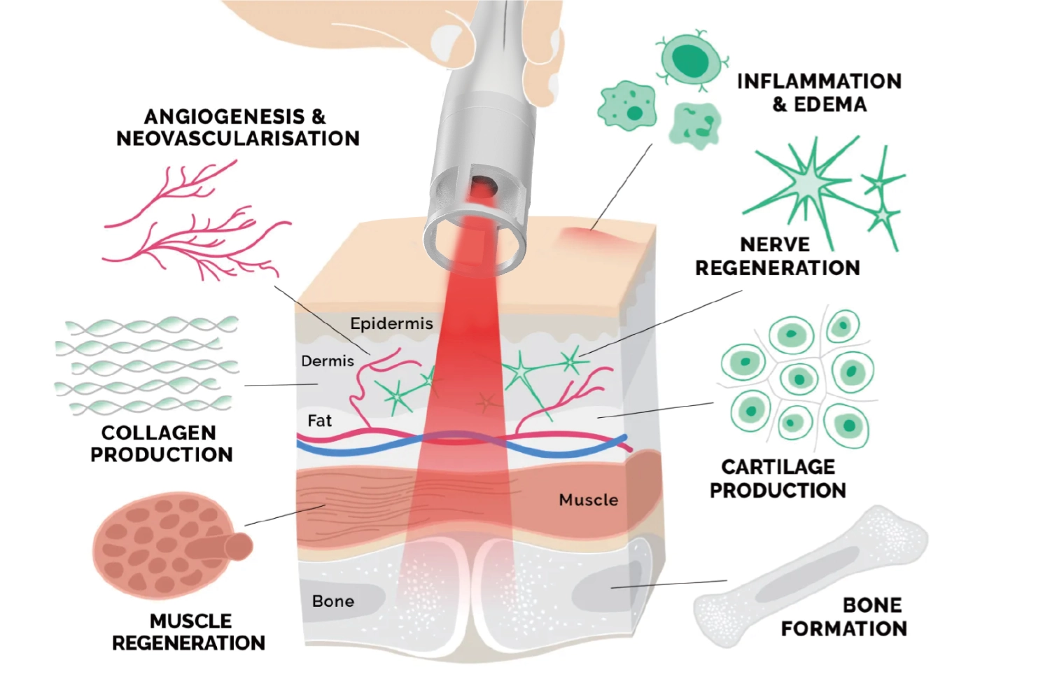 High-power-laser-therapy.webp