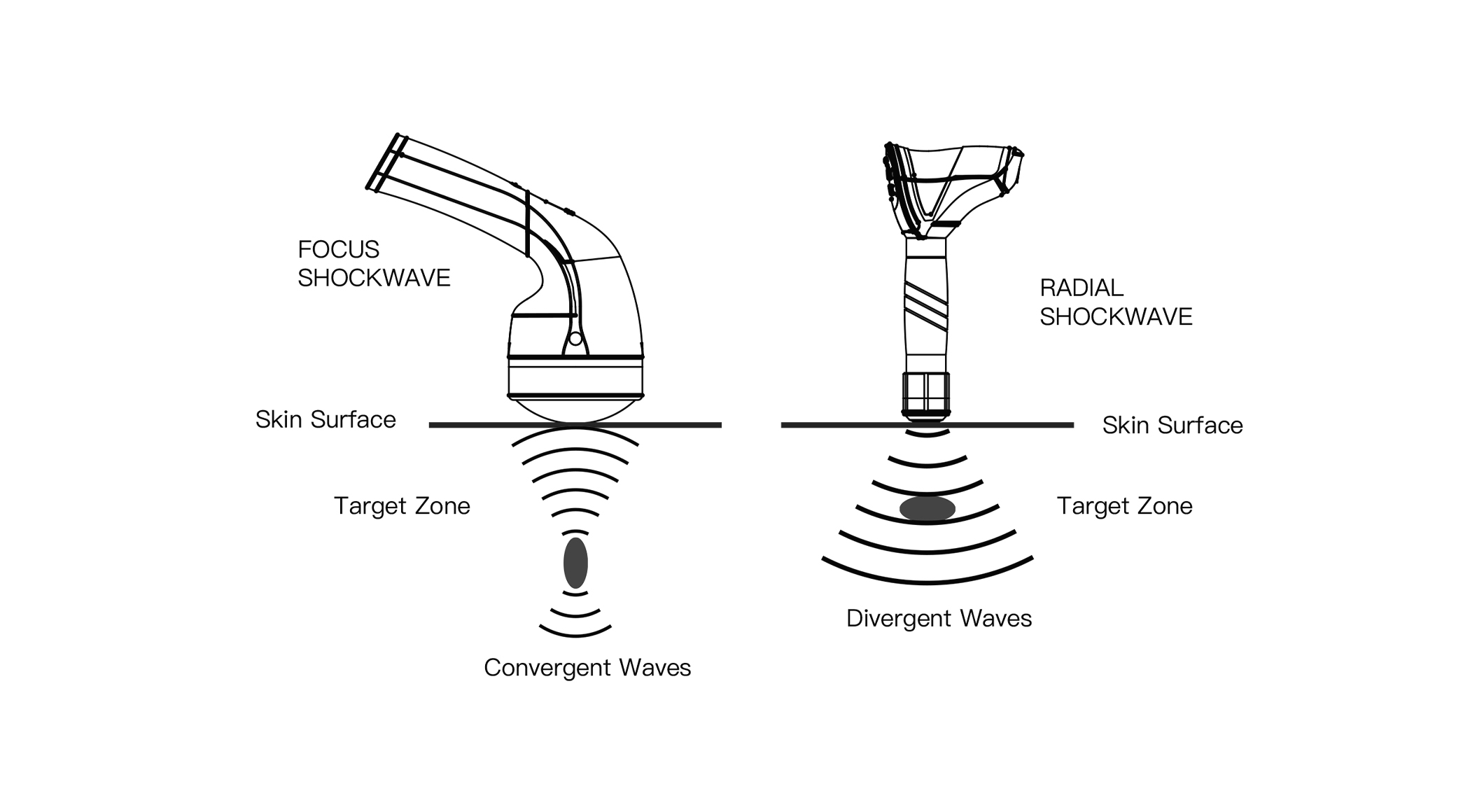 shockwave-therapy-machine-focused.jpg